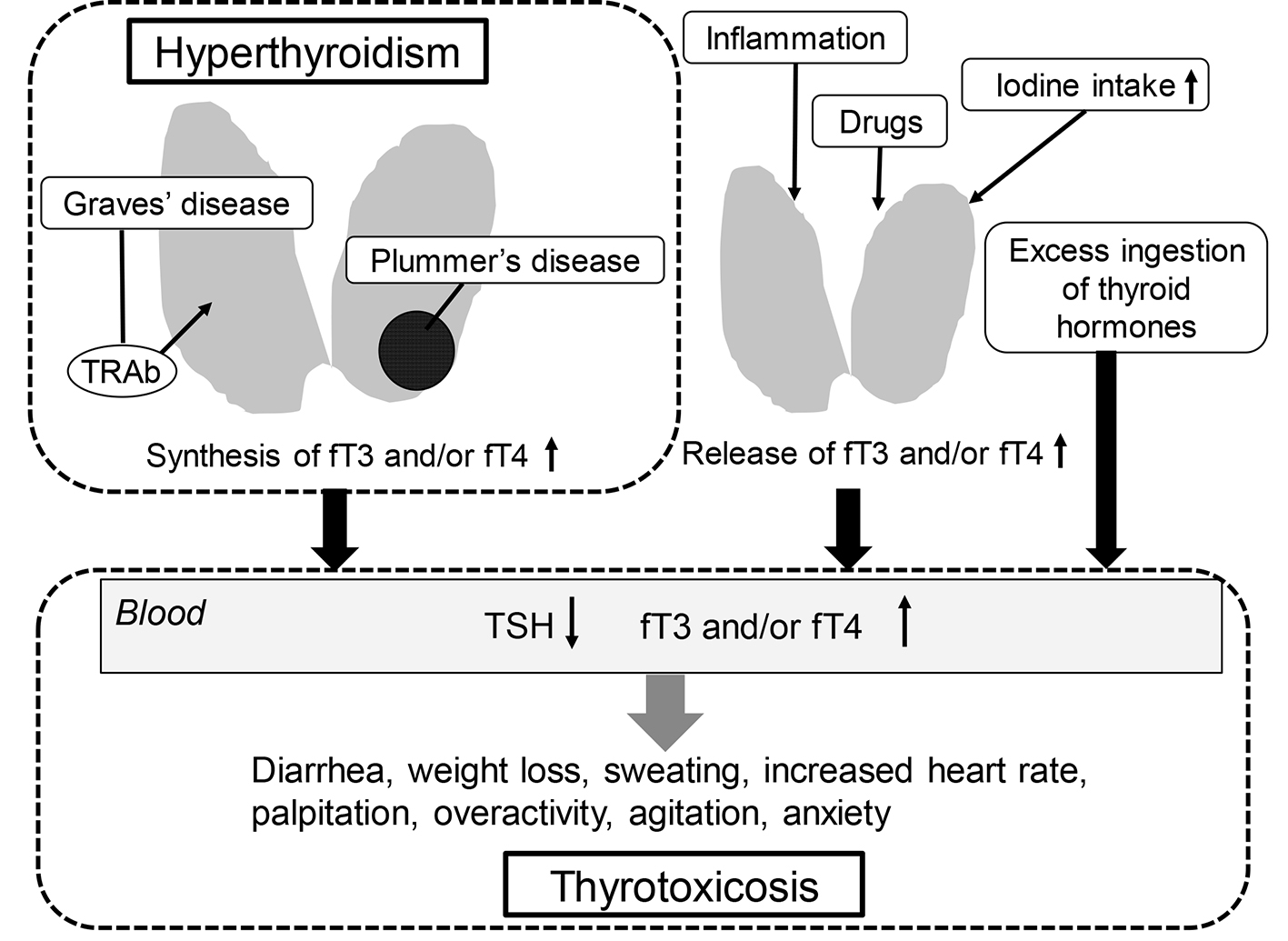 Differential Diagnosis Of Thyrotoxicosis Yanai Journal Of Endocrinology And Metabolism